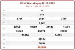 hướng dẫn sử dụng ket qua xo so gia lai hom nay