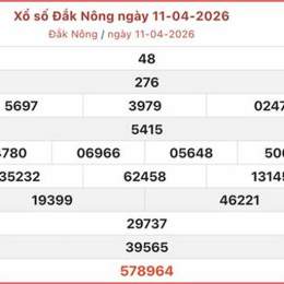 so xo dak nong hom nay