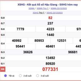 xổ số hậu giang 30